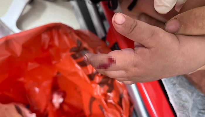 1 yaşında solunum felaketi: Uzmanlar uyarıyor: "1 ayda 4-5 hastamız oldu"