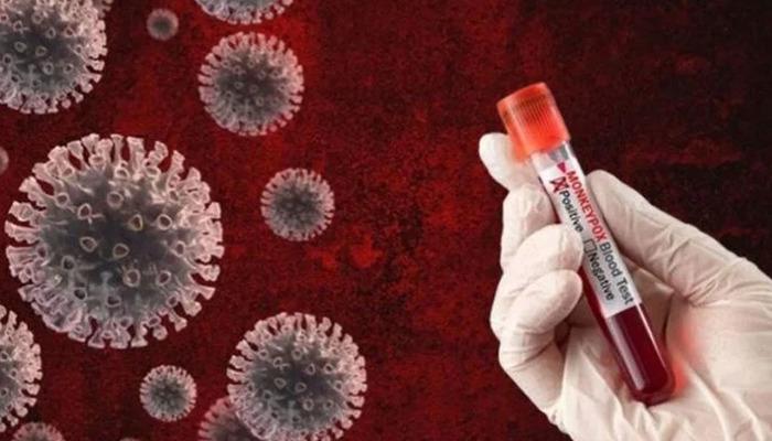 M Pox virüsü 18 ülkeye yayıldı! Ölü sayısı bini aştı... Belirtileri ve tedavi yöntemi neler?
