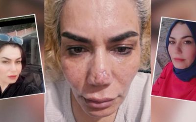 Estetik Ameliyatı Sonrası Mduriyet Yaşayan Kadın, Doktoruna ve Klinike Soruşturma Açtı